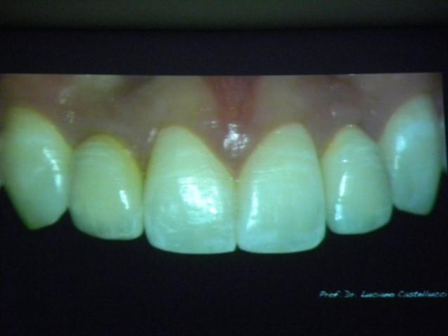 fotos-odonto-implanto-161210-13-640x480-jpg