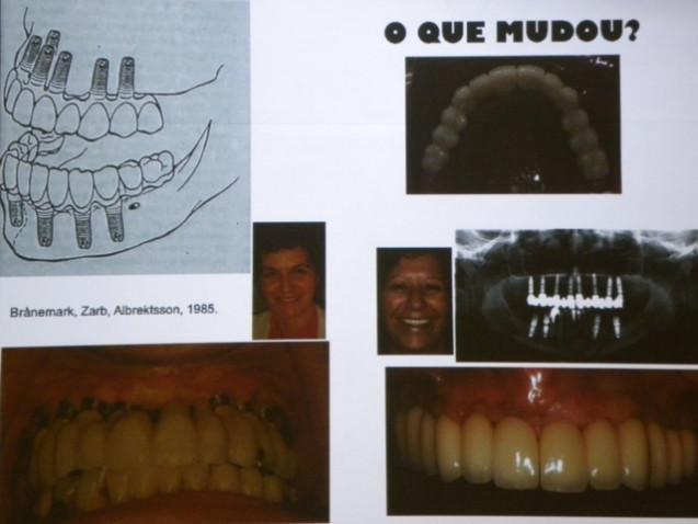 fotos-odontologia-implantodontia-290710-jpg-14c-640x480-1-jpg